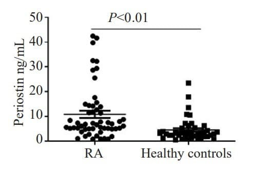 ELH-POSTN was used to measure periostin levels in serum samples from rheumatoid arthritis patients and healthy controls. Figure adapted from Han et al., J South Med Univ, 2022.