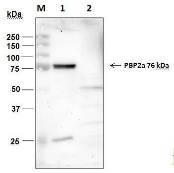 Anti-MRSA Antibody