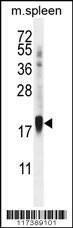 Anti-Mouse ZNF593 (Center) Antibody