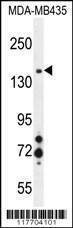 Anti-MET Antibody