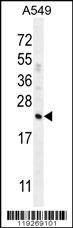 Anti-CFD (N-term) Antibody