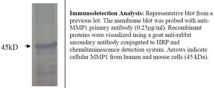 Anti-MMP1 Antibody