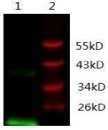 Anti-VEGF Antibody