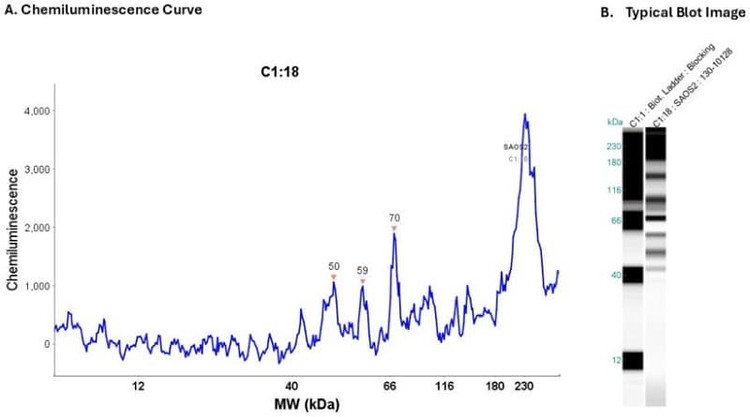 Cell Lysate: SAOS2 0.2 mg/ml | Secondary Ab: Rabbit | Exposure: 30 sec | Expected MW (kDa): 55