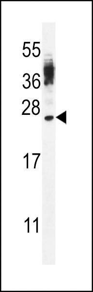 Anti-CT45A4/CT45A3/CT45A2/CT45A1/CT45A6 (Center) Antibody
