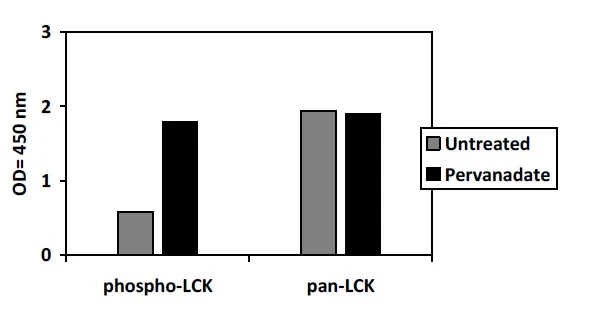Human Phospho-LCK (Y394) ELISA Kit