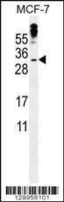 Anti-MBD3L3 (C-term) Antibody