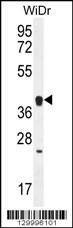 Anti-OR2T8 (C-term) Antibody