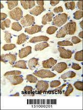 Anti-hCG_1645727 (C-term) Antibody
