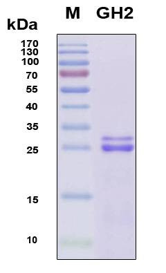 Recombinant Human Growth Hormone 2 (GH2) Protein, Antigen Grade