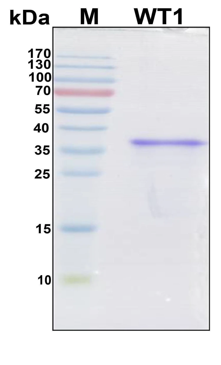 Recombinant Human Wilms Tumor 1 Protein, Antigen Grade