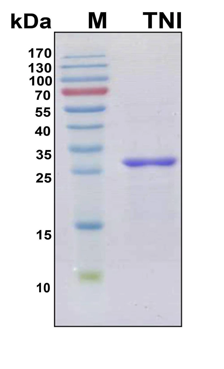 Recombinant Human Troponin I Protein, Antigen Grade