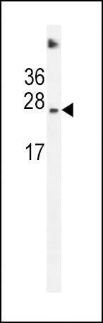 Anti-SDHD (N-term) Antibody