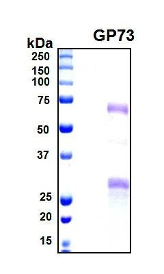 Recombinant Human GP73 Protein