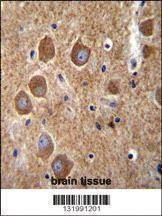 Anti-PAK6 (Center) Antibody