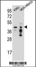 Anti-PCYT1A (N-term) Antibody