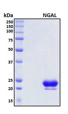 Recombinant Human Lipocalin 2 (NGAL) Protein