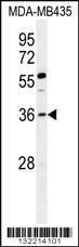 Anti-FOXE3 (Center) Antibody