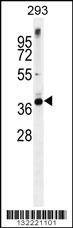 Anti-STX16 (C-term) Antibody