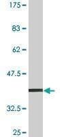 Anti-C1orf57 Antibody