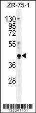 Anti-PYGO1 (C-term) Antibody