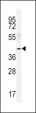 Anti-NEU2 (N-term) Antibody