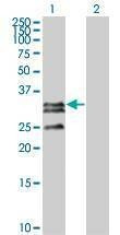 Anti-C1QTNF2 Antibody