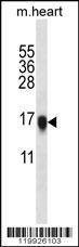Anti-VSNL1 (Center) Antibody