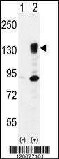 Anti-ITGA5 (Center) Antibody