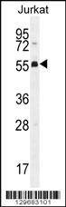 Anti-PODNL1 (Center) Antibody
