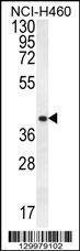Anti-CCNYL3 (N-term) Antibody