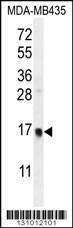 Anti-UNQ6493 (C-term) Antibody