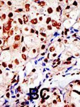 Anti-SUMO1 (N-term E67) Antibody