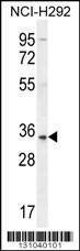 Anti-SFTPA2B (C-term) Antibody