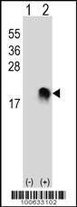 Anti-SUMO2/3 (N-term) Antibody