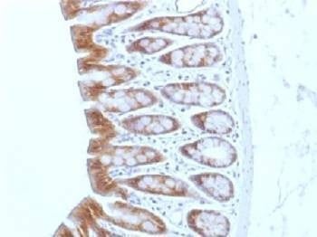 Anti-Beta Catenin Antibody