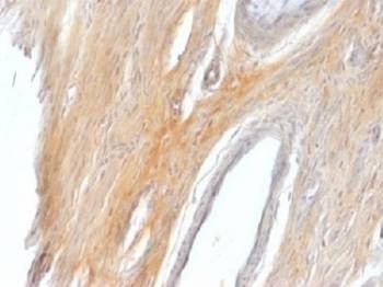 Anti-Caldesmon / CAD Antibody HMW