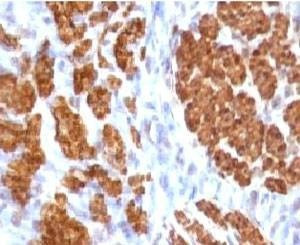 Anti-Calponin Antibody