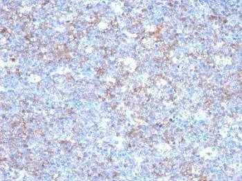 Anti-CD146 Antibody