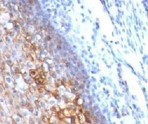 Anti-CD146 Antibody