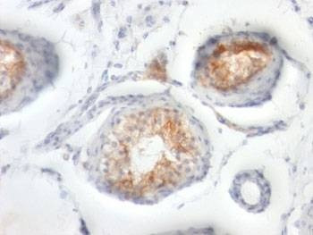 Anti-CD147 Antibody