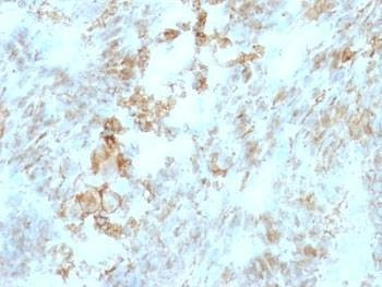 Anti-CD147 Antibody