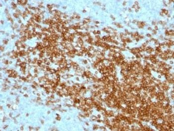 Anti-CD43 Antibody