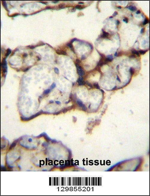 Anti-PLCXD2 (Center) Antibody