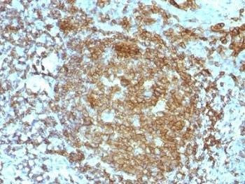 Anti-CD45RA Antibody