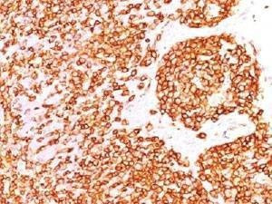Anti-CD45RB Antibody