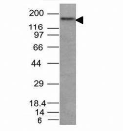 Anti-CD56 Antibody