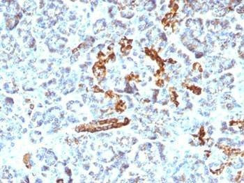 Anti-CD56 Antibody