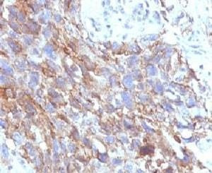 Anti-CD56 Antibody