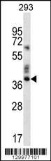Anti-OR9K2 (C-term) Antibody